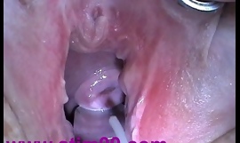 Cum Launching run wide Syringe in Cervix Utherus after Shagging