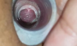 A close up look at the wifes cervix